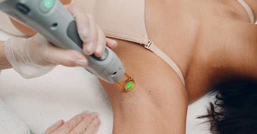 The Ultimate Guide to Laser Hair Removal Therapy