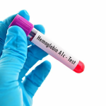 What Is a Haemoglobin Blood Test? Know the Purpose, Procedure, and Results