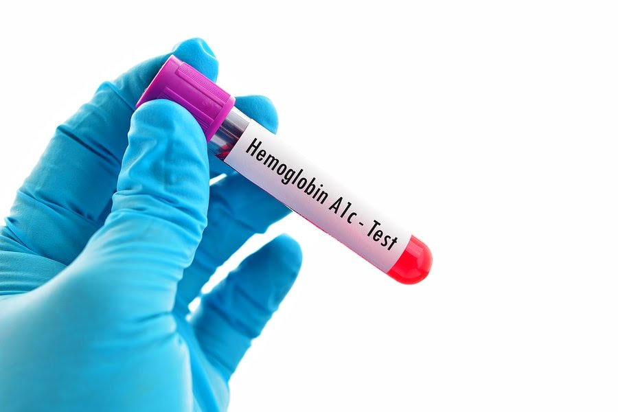 What Is a Haemoglobin Blood Test? Know the Purpose, Procedure, and Results