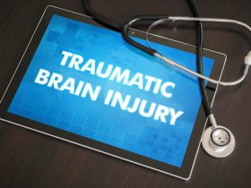 Everything You Need to Know About Hiring a Brain Injury Lawyer
