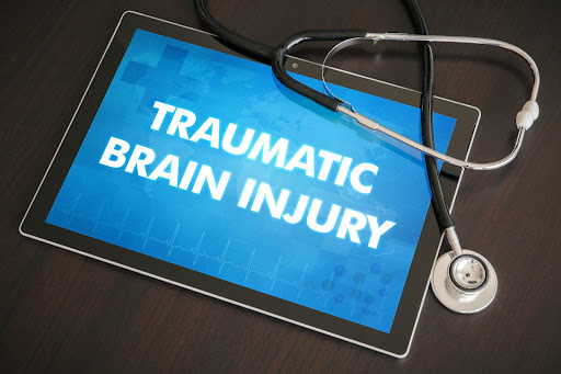 Everything You Need to Know About Hiring a Brain Injury Lawyer
